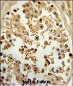 eIF4E Polyclonal Antibody