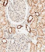 GLS2 Polyclonal Antibody