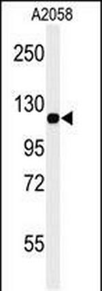 CD146 Antibody in Western Blot (WB)