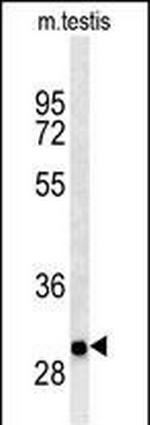 ITGB1BP3 Polyclonal Antibody
