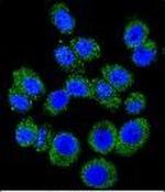 M6PR Polyclonal Antibody