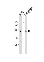 SMPD2 Polyclonal Antibody