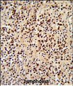 LCK Polyclonal Antibody