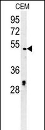 DSCC1 Polyclonal Antibody