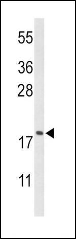Cofilin Antibody in Western Blot (WB)