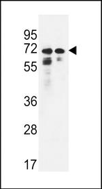 PNPLA8 Polyclonal Antibody