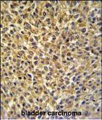 CRIP1 Polyclonal Antibody
