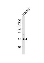 SPRN Antibody in Western Blot (WB)
