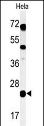 CP054 Polyclonal Antibody