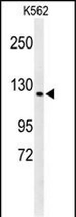 CTC1 Polyclonal Antibody