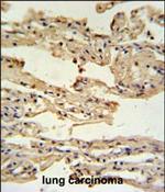 IFITM2 Polyclonal Antibody