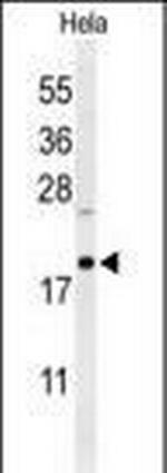 CLEC2B Polyclonal Antibody