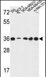 TOR1B Polyclonal Antibody
