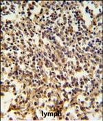 RNaseH2B Polyclonal Antibody