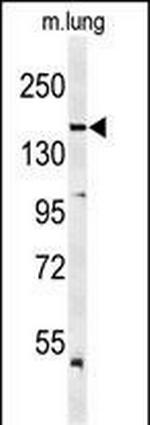 VEGF Receptor 2 Polyclonal Antibody