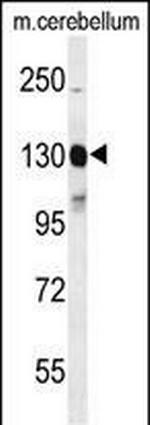 c-Kit Antibody in Western Blot (WB)