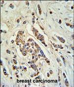 ABCC11 Polyclonal Antibody