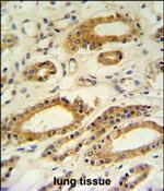 DDO Polyclonal Antibody
