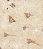 Epiregulin Polyclonal Antibody