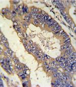 Epiregulin Antibody in Immunohistochemistry (Paraffin) (IHC (P))