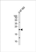 Epiregulin Antibody in Western Blot (WB)