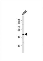 Epiregulin Antibody in Western Blot (WB)