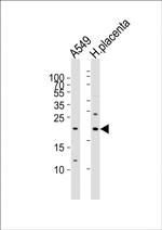 Epiregulin Antibody in Western Blot (WB)