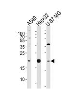 Epiregulin Antibody in Western Blot (WB)