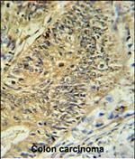 RPS15A Polyclonal Antibody
