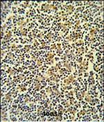 Coronin 6 Polyclonal Antibody
