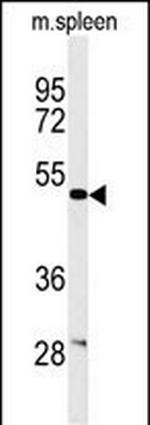 Coronin 6 Antibody in Western Blot (WB)