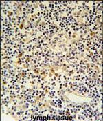 Coronin 6 Antibody in Immunohistochemistry (Paraffin) (IHC (P))