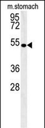 Coronin 6 Antibody in Western Blot (WB)