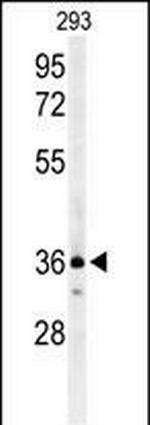 CCR1 Antibody in Western Blot (WB)