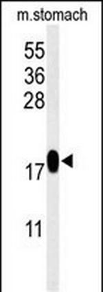 TXNDC12 Antibody in Western Blot (WB)
