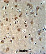 YME1L1 Polyclonal Antibody