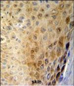 GSDMA Polyclonal Antibody