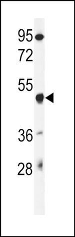GSDMA Antibody in Western Blot (WB)