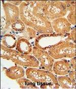 COQ9 Polyclonal Antibody