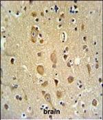 APITD1 Polyclonal Antibody