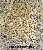 FUT6 Polyclonal Antibody