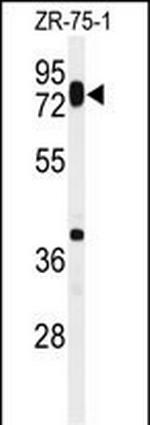 HAS1 Polyclonal Antibody
