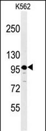 SEZ6L2 Polyclonal Antibody