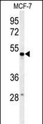 PSG7 Antibody in Western Blot (WB)