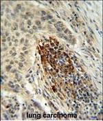 MFAP4 Polyclonal Antibody