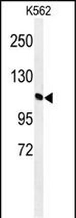 GTF2IRD2 Polyclonal Antibody