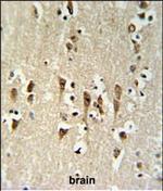 KCTD1 Polyclonal Antibody