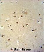 RRAGD Polyclonal Antibody