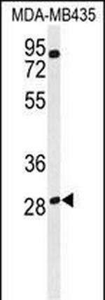 RRAGD Antibody in Western Blot (WB)