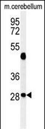 RRAGD Antibody in Western Blot (WB)